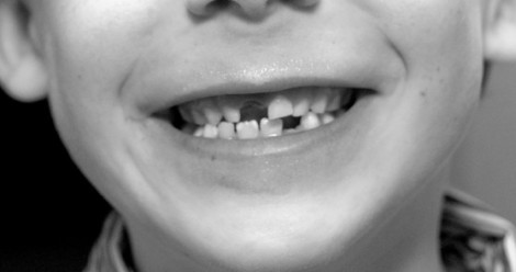 Denti da Latte e permanenti